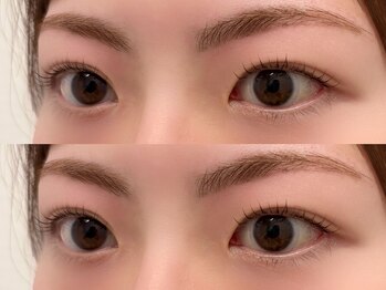 ヨーク トゥルペ(yorke tulpe)/ラッシュリフト&眉毛