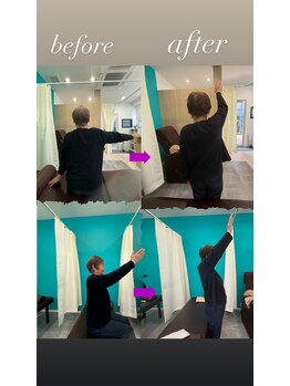 西宮ヤノ整骨院/姿勢改善で肩が上がります。