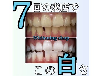 ホワイトニングショップ 長崎店/ホワイトニング