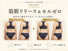 プレリー 自由が丘店/筋膜リリースで背中スッキリ