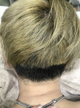 ナノハナ/鹿沼市の全身脱毛のナノハナ