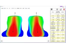 距骨サロン 湘南茅ヶ崎店/3D測定画像♪