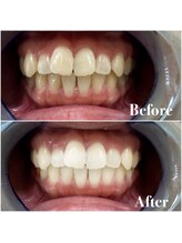 ライトビューティー 池袋店(LightBeauty)/症例写真