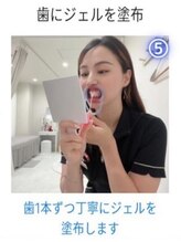 ホワイトニングショップ 三島店(WHITENING SHOP)/【ホワイトニングの流れ】５