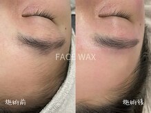 ミコサロン(miko salon)/フェイスワックス