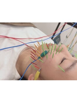 鍼灸施術を受けたい