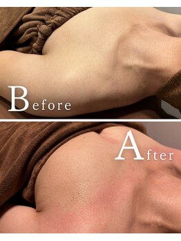 ロココ 水戸店(Rococo)/バストアップBefore After