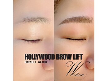 ウェリナ(welina)/