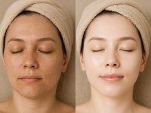 シャイニングビューティー 表参道(Shining Beauty)の雰囲気（【美白/美肌小顔】肌質改善～シミたるみケアオーダーメイド施術）