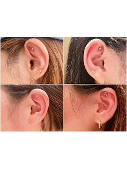 小顔になりたい