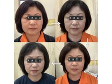 トータルヘルスビューティーカズ(TotalHealthBeauty KAZU)の雰囲気(寝ているだけで小顔・毛穴・シミしわ改善できる光美容を体験♪)