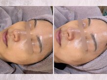 ソワナ(soina)の雰囲気（＜素肌をキレイにする＞豊富な美肌育成メニューで素肌美人に。）