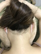 ナノハナ/鹿沼市の全身脱毛のナノハナ