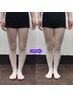 【美脚GET！！】O脚改善＆太ももの張りスッキリ！　¥4980