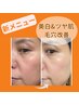 【NEW】陶肌ピール☆¥11000→¥9900 保湿しながら肌を磨き上げる！