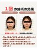 【目線隠してお顔写真投稿OKな方限定】美容鍼+小顔マッサージ★お試し¥3680