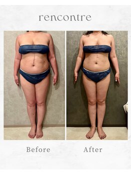 ランコント(rencontre)/肩こり/リンパ/ヘッドスパ/痩身