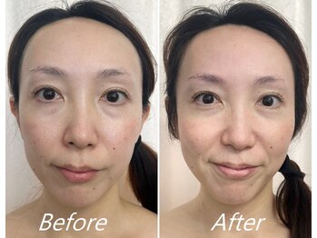 ドクターボディ 新宿店(Dr.Body)/【中顔面短縮/歪み/左右差40代】