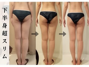 ビューティーグランツ(beauty granz)/脚のラインが変わる