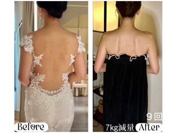 ソウ バイ ソウ(So by 蒼)/9回で-7,5キロ!強い刺激は逆効果