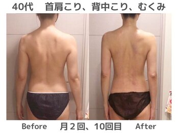 マテリアル(MATERIAL)/背中こり放置で痩せにくくなった