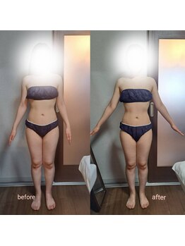 エテルノ(eterno)の写真/上半身の贅肉をボリューム減!猫背,姿勢もスッキリ★40代50代から「痩せた」「見た目変わった」と口コミ多数