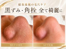 エステサロン ジョアアンジェ(joie ange)