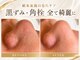 エステサロン ジョアアンジェ(joie ange)の写真