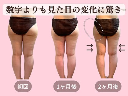ヨサパーク 美 キレイ(YOSA PARK 美 Kirei)の写真