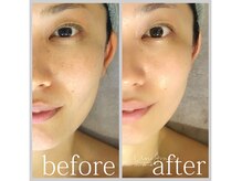 アン グレーヌ 自由が丘(unegraine)/瞳スッキリ！もたつき解消！