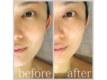 アン グレーヌ 自由が丘(unegraine)/瞳スッキリ！もたつき解消！