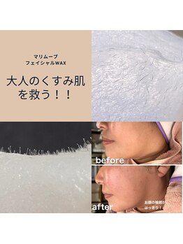 ジョワ アイラッシュサロン(joie)/マリムーブフェイシャルワックス