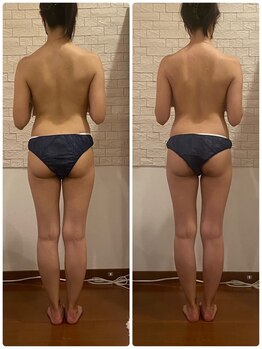 うつくし痩身 美サロン ゼットワン(Z-ONE)/ボディ　メディセル＋マッサージ