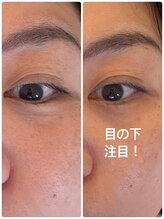 ルーシーガーデン(LUCY GARDEN)/ピーリング 50代女性