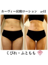 ケンビラク(Kenbiraku 健美楽)/くびれ・ふともも　ホームケア