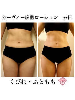 ケンビラク(Kenbiraku 健美楽)/くびれ・ふともも　ホームケア