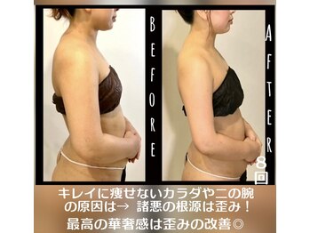 ソウ バイ ソウ(So by 蒼)/8～10キロ以上減量希望→10~12回