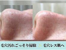アップル 御幸ヶ原店(Apple.)の雰囲気（毛穴ケアも充実！施術後のスベスベツルツルをご堪能ください）