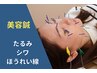 【シワ、たるみ改善】お顔のお悩み改善＊美容鍼　¥6,600→¥4,500