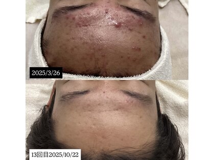 リンフェイス 池袋店(RIN FACE)の写真