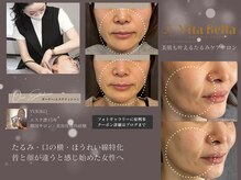 ヴィタベラ(Vita Bella)