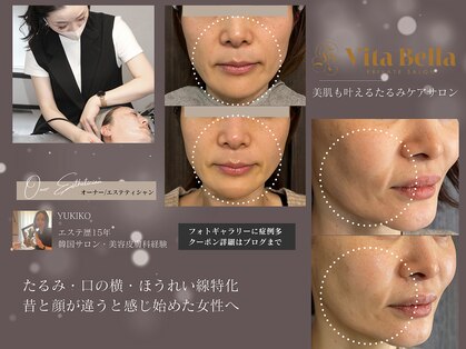 ヴィタベラ(Vita Bella)の写真