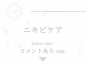 ラヴィオーラ 烏丸(LV)/施術イメージ