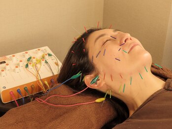 ベル(BELLE)の写真/《美容鍼/小顔鍼》即効性×効果実感で満足度◎お顔の大きさ/食いしばり等でのエラの張りなどが気になる方も