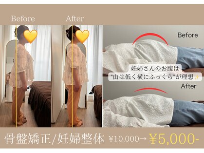 エクラ(eclat)の写真