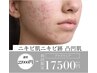 【ニキビケア 】人気ＮＯ１凸凹肌長年お悩みの方はコレ！！！¥22000→¥17500