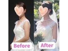 ボディキュア ブライダル美容整体 大阪梅田/【まるで別人】全身スッキリ★