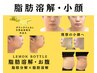 レモンボトルモニター◆二重あご・小顔・輪郭【ラジオ波・ポレーション付き】