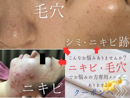 ホロホロ(holoholo)の写真