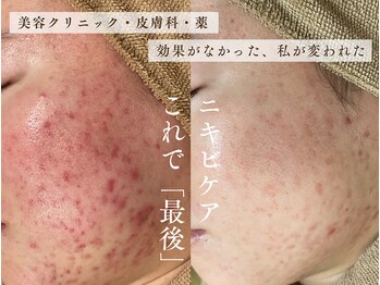 サロンドレナ 名駅店